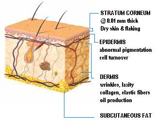 SKIN crosscut